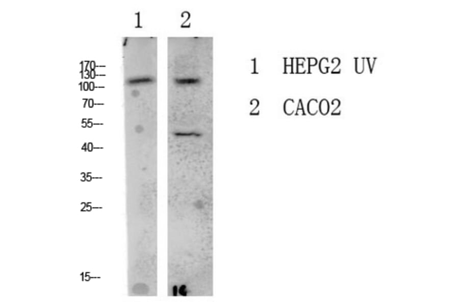 Western Blot - Anti-LATS1 + LATS2 Antibody (B8125) - Antibodies.com