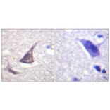 Immunohistochemistry - Anti-CEBP epsilon Antibody (B0827) - Antibodies.com