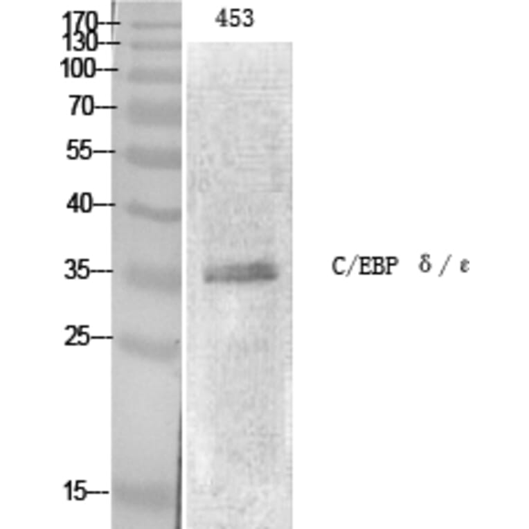 Western Blot - Anti-CEBP epsilon Antibody (B0827) - Antibodies.com
