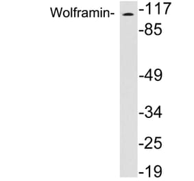 Western Blot - Anti-Wolframin Antibody (R12-2414) - Antibodies.com