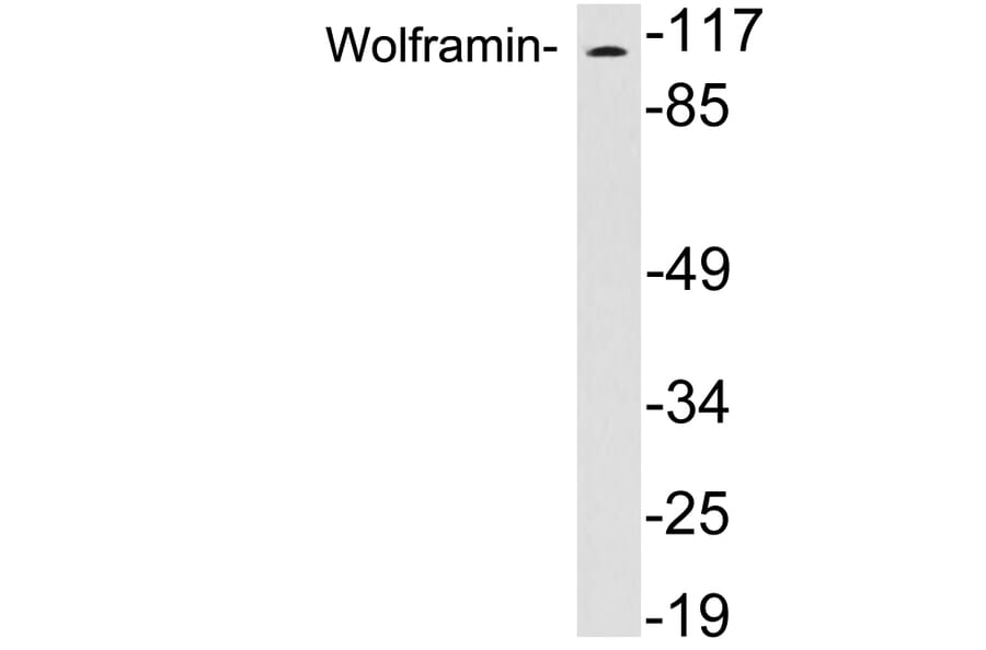 Western Blot - Anti-Wolframin Antibody (R12-2414) - Antibodies.com