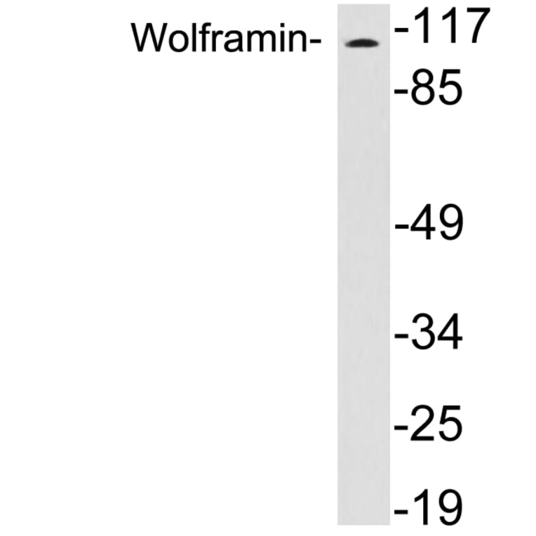 Western Blot - Anti-Wolframin Antibody (R12-2414) - Antibodies.com