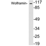 Western Blot - Anti-Wolframin Antibody (R12-2414) - Antibodies.com