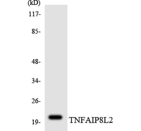 Western Blot - Anti-TNFAIP8L2 Antibody (R12-3637) - Antibodies.com