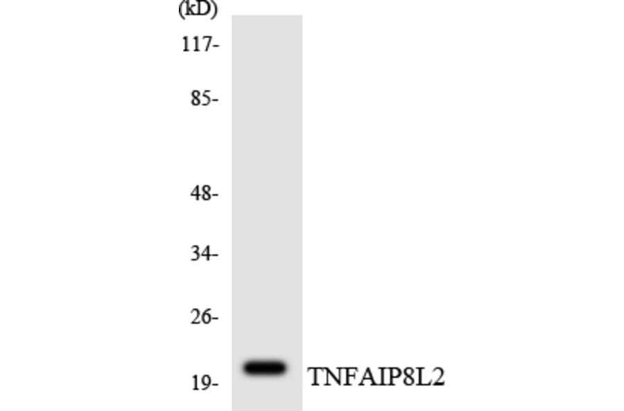 Western Blot - Anti-TNFAIP8L2 Antibody (R12-3637) - Antibodies.com