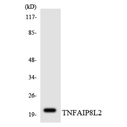 Western Blot - Anti-TNFAIP8L2 Antibody (R12-3637) - Antibodies.com
