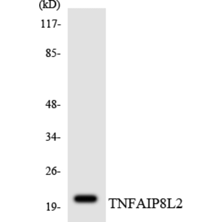 Western Blot - Anti-TNFAIP8L2 Antibody (R12-3637) - Antibodies.com