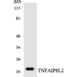 Western Blot - Anti-TNFAIP8L2 Antibody (R12-3637) - Antibodies.com