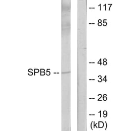 Western Blot - Anti-Serpin B5 Antibody (C13117) - Antibodies.com