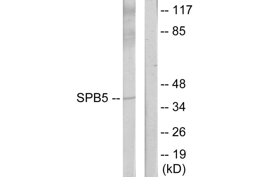 Western Blot - Anti-Serpin B5 Antibody (C13117) - Antibodies.com