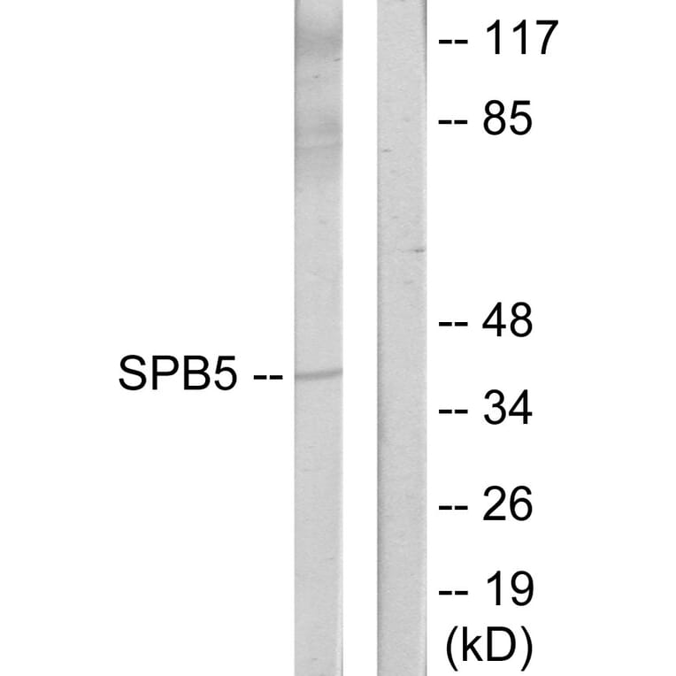 Western Blot - Anti-Serpin B5 Antibody (C13117) - Antibodies.com