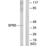 Western Blot - Anti-Serpin B5 Antibody (C13117) - Antibodies.com
