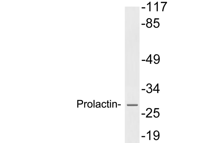 Western Blot - Anti-Prolactin Antibody (R12-2322) - Antibodies.com