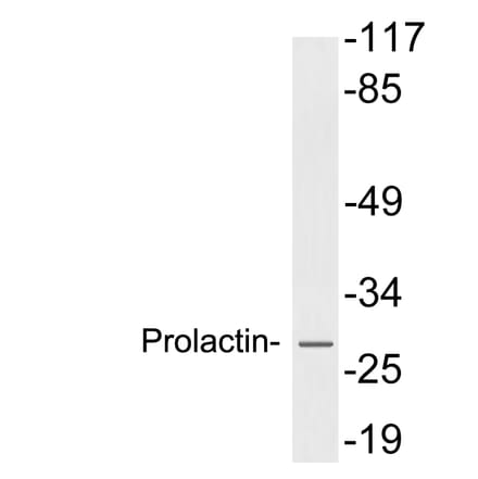 Western Blot - Anti-Prolactin Antibody (R12-2322) - Antibodies.com
