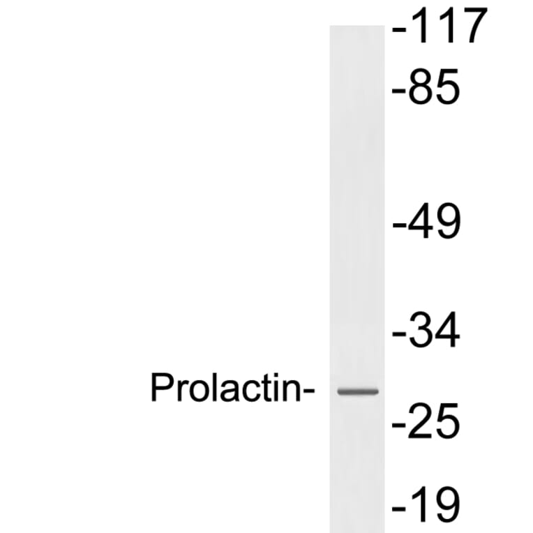 Western Blot - Anti-Prolactin Antibody (R12-2322) - Antibodies.com