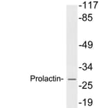 Western Blot - Anti-Prolactin Antibody (R12-2322) - Antibodies.com