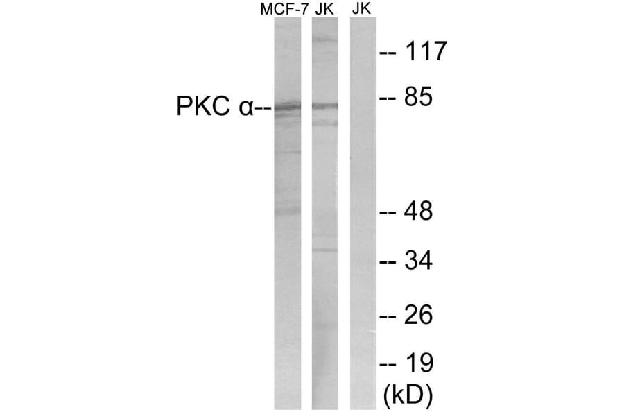 Western Blot - Anti-PKC alpha Antibody (B0800) - Antibodies.com
