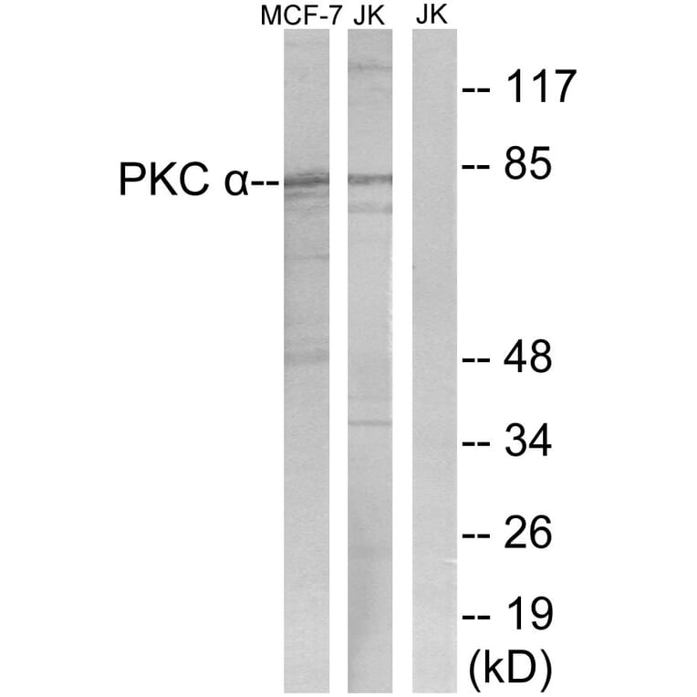 Western Blot - Anti-PKC alpha Antibody (B0800) - Antibodies.com