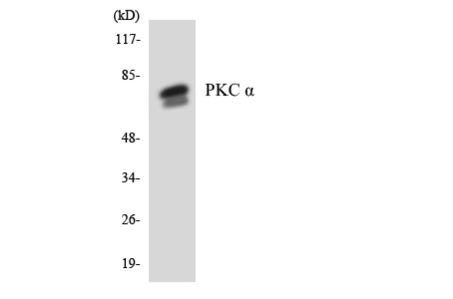 Western Blot - Anti-PKC alpha Antibody (R12-3330) - Antibodies.com