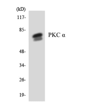 Western Blot - Anti-PKC alpha Antibody (R12-3330) - Antibodies.com