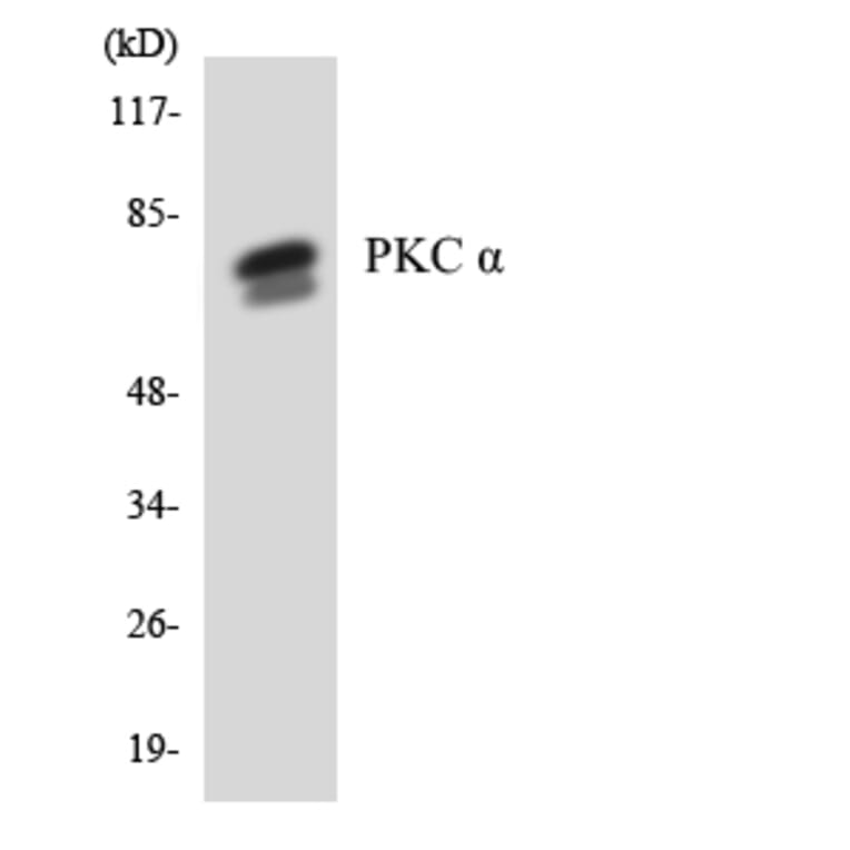 Western Blot - Anti-PKC alpha Antibody (R12-3330) - Antibodies.com