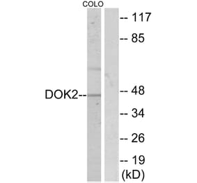 Western Blot - Anti-p56 Dok-2 Antibody (B7059) - Antibodies.com