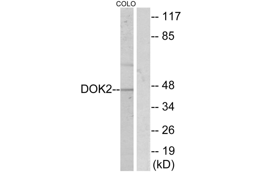 Western Blot - Anti-p56 Dok-2 Antibody (B7059) - Antibodies.com
