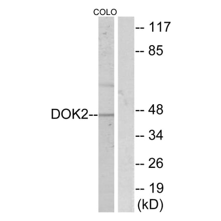 Western Blot - Anti-p56 Dok-2 Antibody (B7059) - Antibodies.com