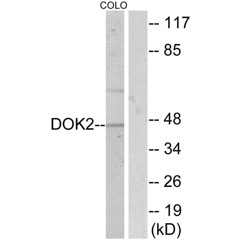 Western Blot - Anti-p56 Dok-2 Antibody (B7059) - Antibodies.com