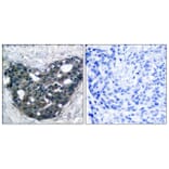 Immunohistochemistry - Anti-p56 Dok-2 Antibody (B7059) - Antibodies.com