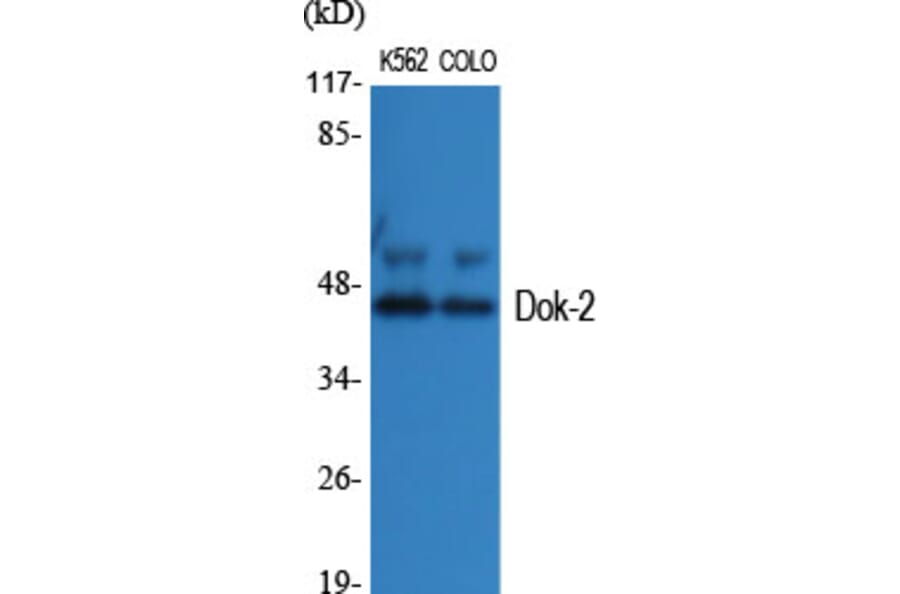 Western Blot - Anti-p56 Dok-2 Antibody (B7059) - Antibodies.com