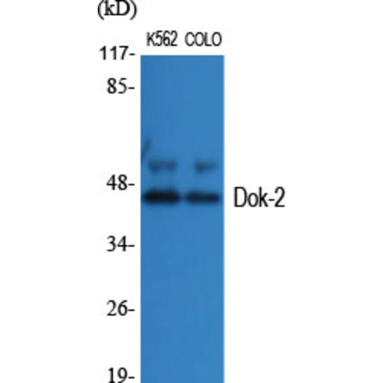 Western Blot - Anti-p56 Dok-2 Antibody (B7059) - Antibodies.com