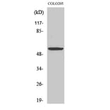 Western Blot - Anti-p56 Dok-2 Antibody (B7059) - Antibodies.com