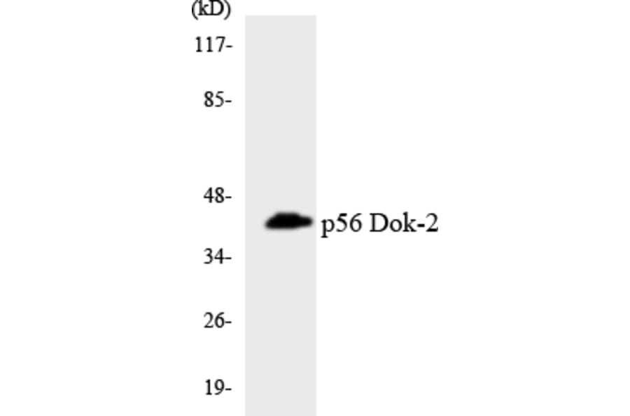Western Blot - Anti-p56 Dok-2 Antibody (R12-3290) - Antibodies.com