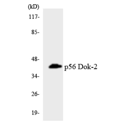 Western Blot - Anti-p56 Dok-2 Antibody (R12-3290) - Antibodies.com