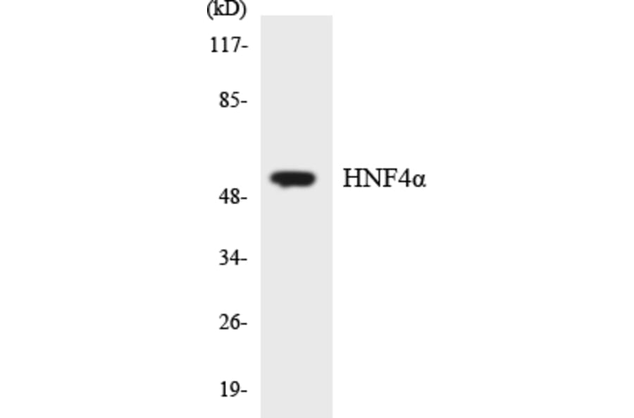 Western Blot - Anti-HNF4alpha Antibody (R12-2884) - Antibodies.com