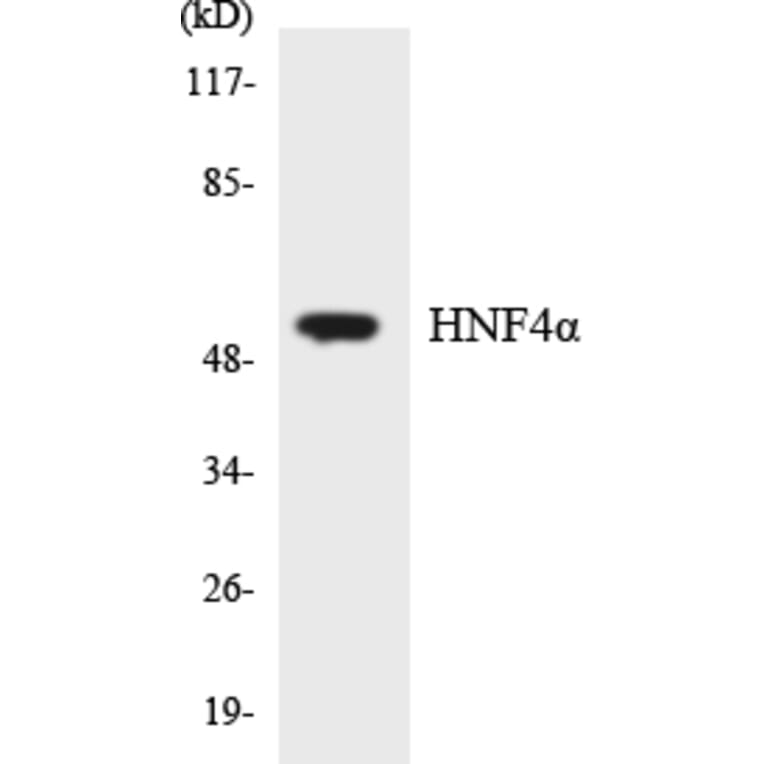 Western Blot - Anti-HNF4alpha Antibody (R12-2884) - Antibodies.com