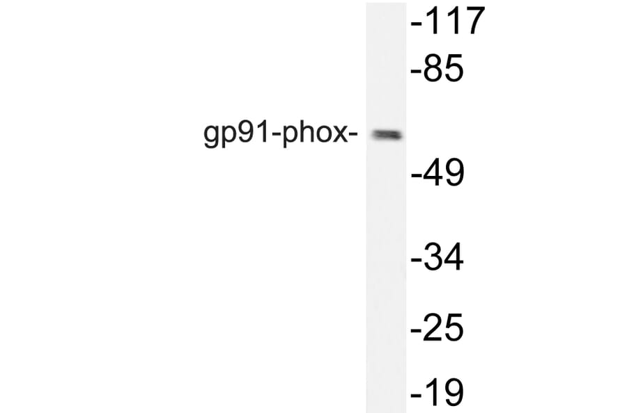 Western Blot - Anti-gp91-phox Antibody (R12-2168) - Antibodies.com