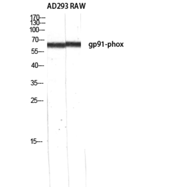 Western Blot - Anti-gp91-phox Antibody (R12-2168) - Antibodies.com