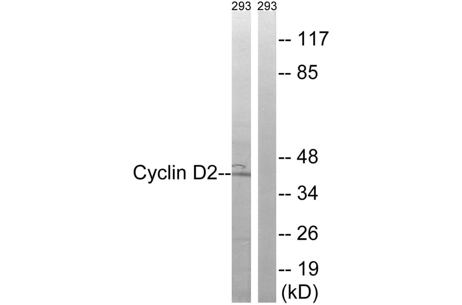 Western Blot - Anti-Cyclin D2 Antibody (B8336) - Antibodies.com