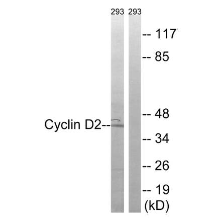 Western Blot - Anti-Cyclin D2 Antibody (B8336) - Antibodies.com