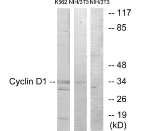 Western Blot - Anti-Cyclin D1 Antibody (B0879) - Antibodies.com