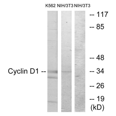 Western Blot - Anti-Cyclin D1 Antibody (B0879) - Antibodies.com