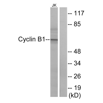 Western Blot - Anti-Cyclin B1 Antibody (B0635) - Antibodies.com