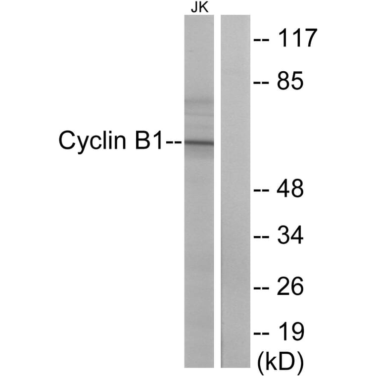 Western Blot - Anti-Cyclin B1 Antibody (B0635) - Antibodies.com