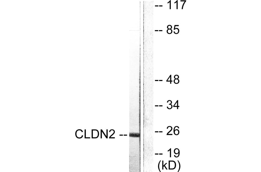 Western Blot - Anti-Claudin 2 Antibody (C0143) - Antibodies.com