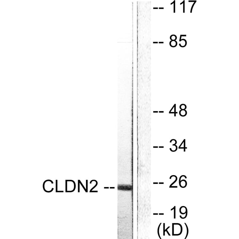 Western Blot - Anti-Claudin 2 Antibody (C0143) - Antibodies.com
