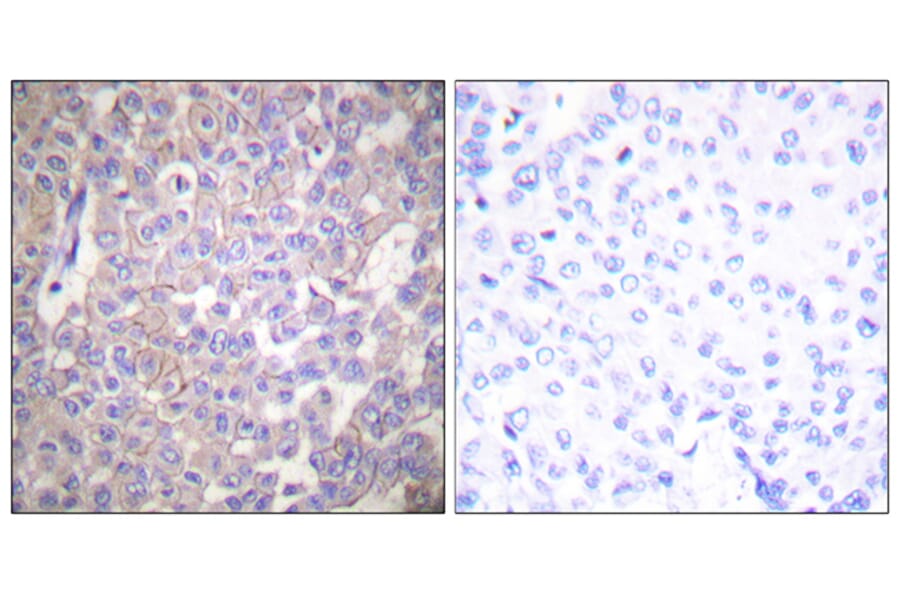 Immunohistochemistry - Anti-Claudin 2 Antibody (C0143) - Antibodies.com