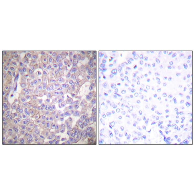 Immunohistochemistry - Anti-Claudin 2 Antibody (C0143) - Antibodies.com
