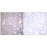 Immunohistochemistry - Anti-Claudin 2 Antibody (C0143) - Antibodies.com